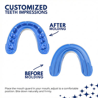 Hynoa | Anti-Snoring Mouthpiece